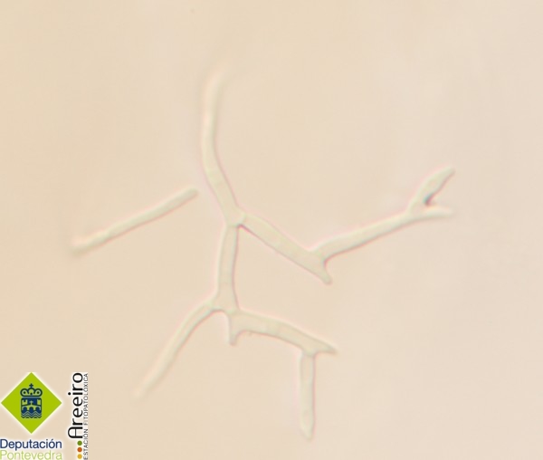 Fusarium circinatum >> Polifialidas típicas de F.circinatum.jpg